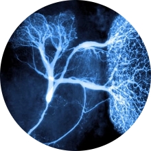 introduccion-a-la-neurocirugia-neurona-gigante